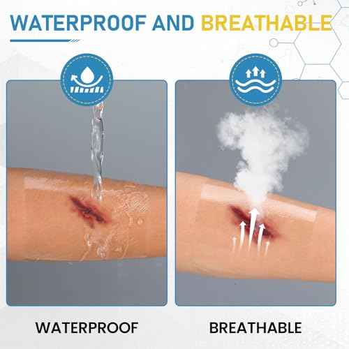 80 Packs Transparent Film Dressing 4" x 4.75", Waterproof Bandages for Wounds, Wound Dressing for Shower or IV Shield, Tattoo Aftercare Bandage, Clear Bandages for Wound Care