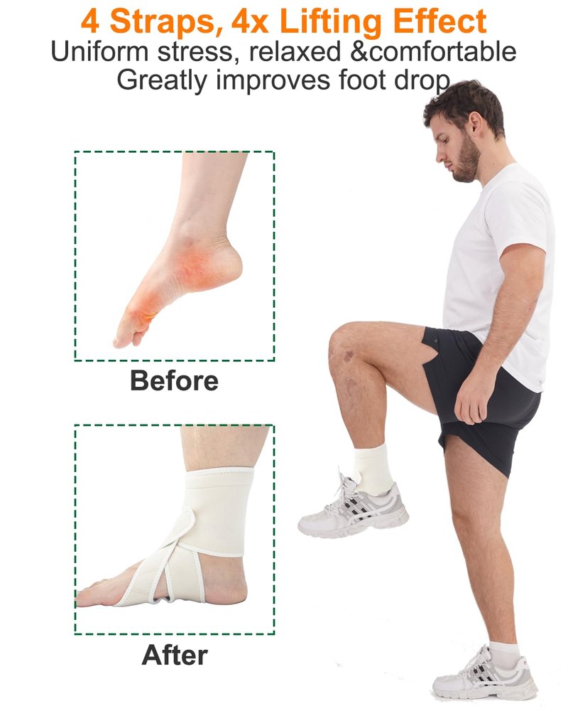 DouHeal AFO Foot Drop Brace, Improve Walking Gait, Effective Relieve Pain, Adjustable Foot Orthosis Brace Support for Sleep, Plantar Fasciitis, Drop Foot Braces For Walking with Shoes[Left]