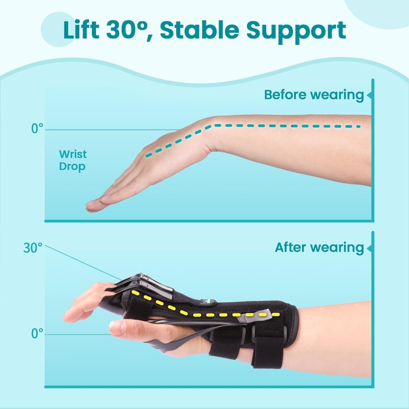 Radial Nerve Palsy Splint Brace for Wrist drop, 5 Fingers Extension, Stroke Patient Recovery, Finger Limp, Crutch Palsy, MCP Arthroplasty, for both Left and Right Hand - Black