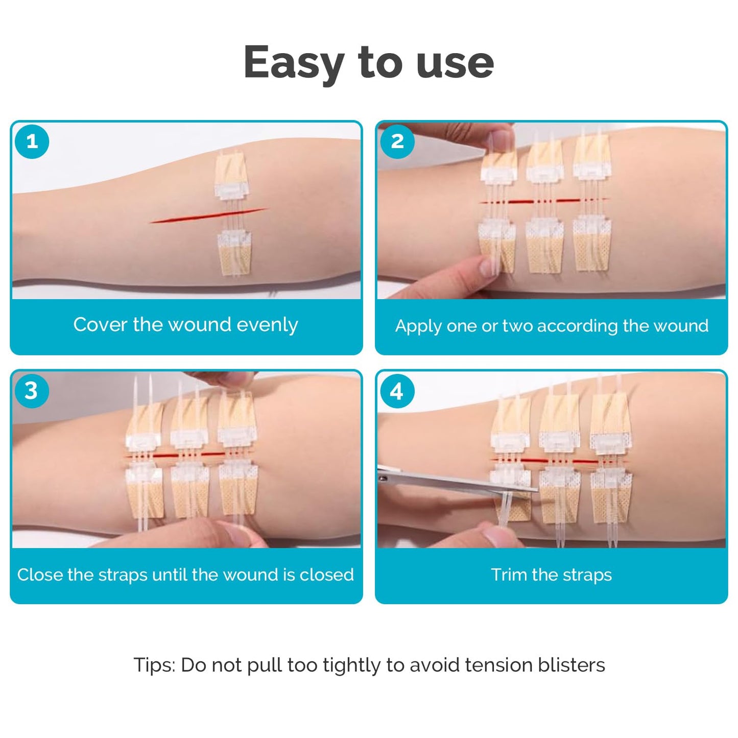 Emergency Wound Closure Strips, 5 Pcs Zip Stitch Butterfly Bandages for Wound Closure, Steri Strips Alternative for Lacerations, Easy Pull Skin Closure Device for First Aid Kits, Home & Outdoor Use