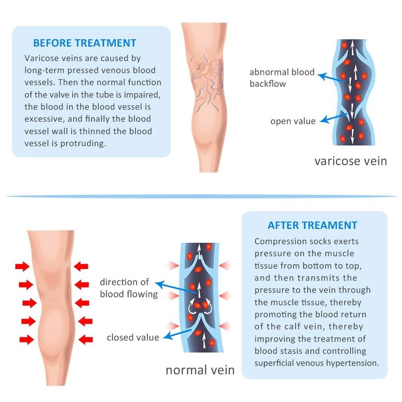 20-30 mmHg Women Compression Pantyhose,Closed Toe Medical Compression Stockings,Waist High Opaque Compression Tights for Varicose Veins,DVT,Graduated Compression Panty Hose for Teacher,2 Pairs-XL