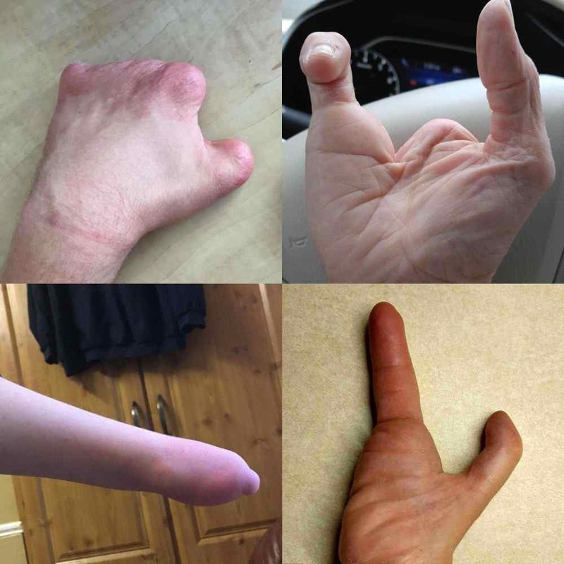 active hands Limb Difference gripping aid (Small, Left)