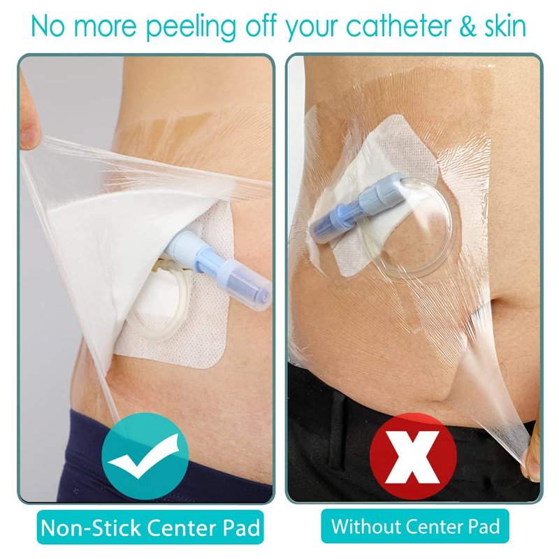 Waterproof Dialysis Port Shower Cover Pd Catheter Shower Shields Dialysis Catheter Shower Protector 9"x9" Picc Line Adhesive Bandage with Non-Stick Center Pad (Pack of 25)