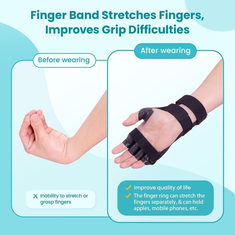 Radial Nerve Palsy Splint Brace for Wrist drop, 5 Fingers Extension, Stroke Patient Recovery, Finger Limp, Crutch Palsy, MCP Arthroplasty, for both Left and Right Hand - Black