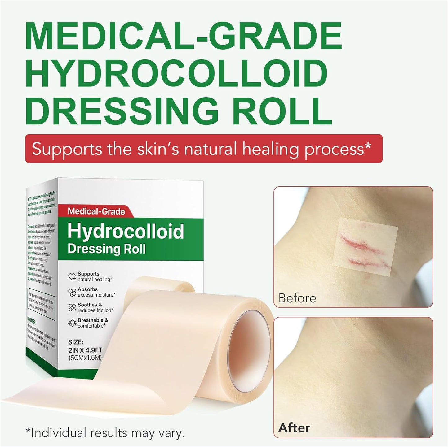 Hydrocolloid Roll - Hydrocolloid Bandages for Wound Care | Ultra Absorbent, Waterproof, 2in x 4.9ft (Beige)