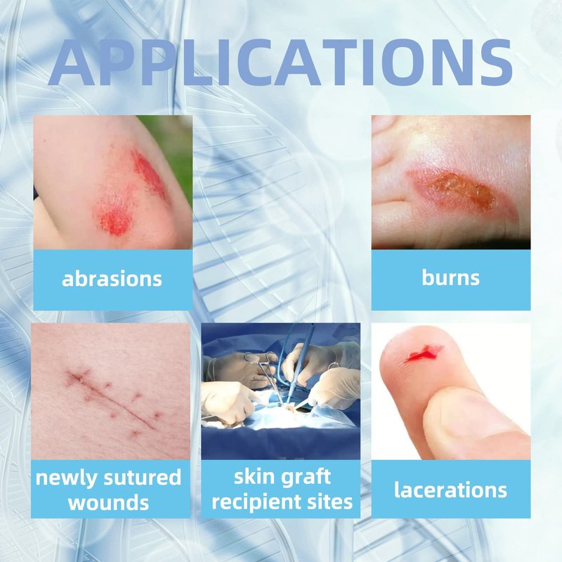 Dr.Med Xeroform Petrolatum Dressing Patch, 5"x9"-30 Pcs/Box, Non-Adherent Gauze Dressings, for Minor or Partial Thickness Burns, Lacerations, Skin Graft Recipient Sites, Newly Sutured Wounds