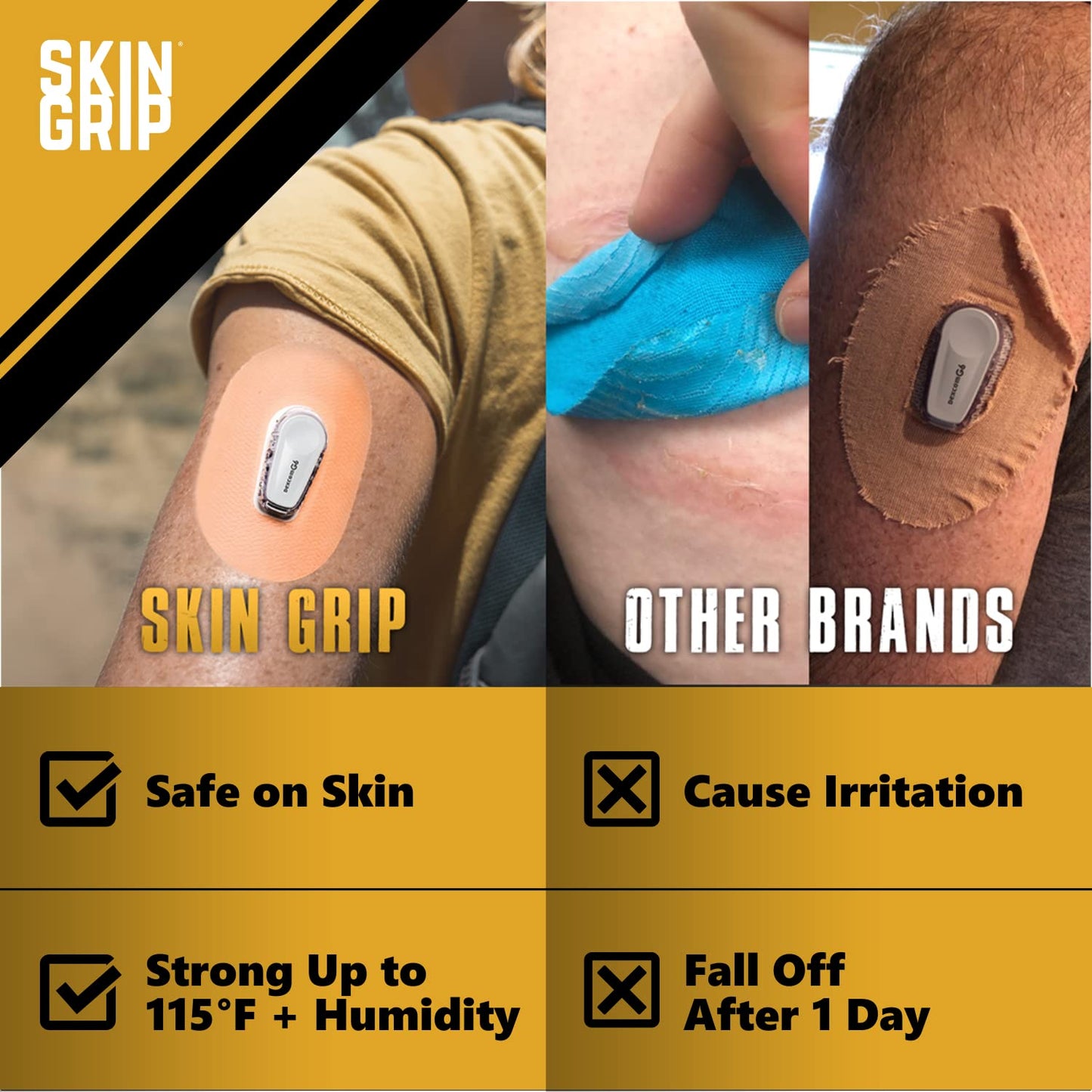 Skin Grip MAX Adhesive Patches Compatible with Dexcom G6 CGM – Pre-Cut, Non-Fraying, Extreme Adhesive Medical Tape – CGM Senor Cover, Waterproof & Sweatproof for 10-14 Days – 10 Pack, Tan