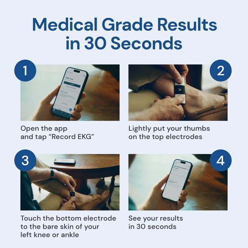 KardiaMobile 6-Lead Personal EKG Monitor – Six Views of The Heart – Detects AFib and Irregular Arrhythmias – Instant Results in 30 Seconds – Works with Most Smartphones - FSA/HSA Eligible