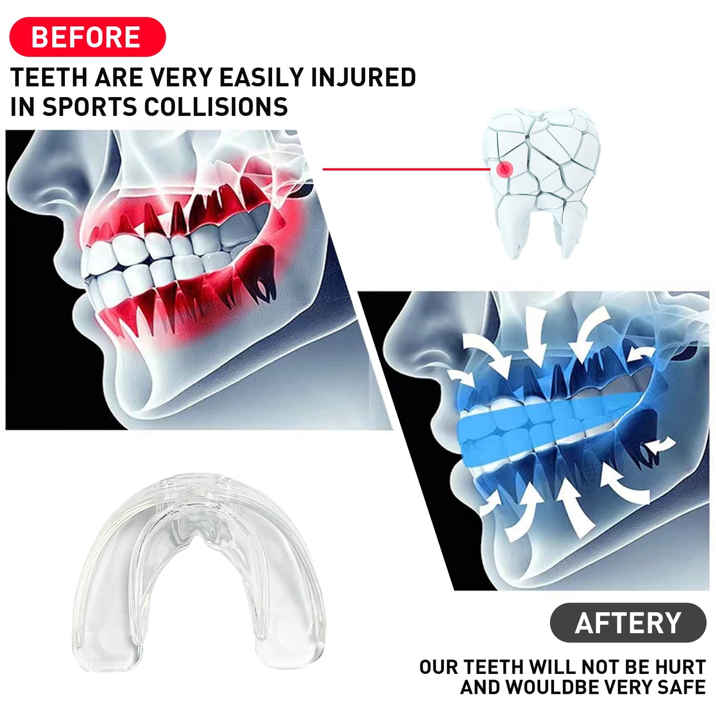 3 Pack Kids Youth Mouth Guard Football Sports Braces Mouthguards for Mouthpiece Boys Teeth for MMA Boxing Rugby Kickboxing Taekwondo Softball Lacrosse to Braces EVA Transparent