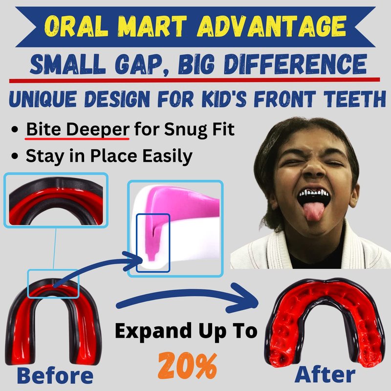 Oral Mart White/Pink Youth Vampire Fangs Mouth Guard for Kids - Youth Mouthguard for Karate, Football, Martial Arts, Taekwondo, Boxing, Rugby, BJJ, Muay Thai, Soccer, Hockey (with Free Case)