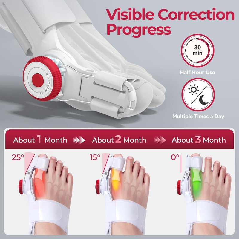 TENICORE Bunion Corrector for Kids, Adjustable Bunions Fix for Relief with Anti-slip Heel Strap, Big toe straightener with Silicone Pad, Fits Left/Right Feet, 1PC, Green-1pc