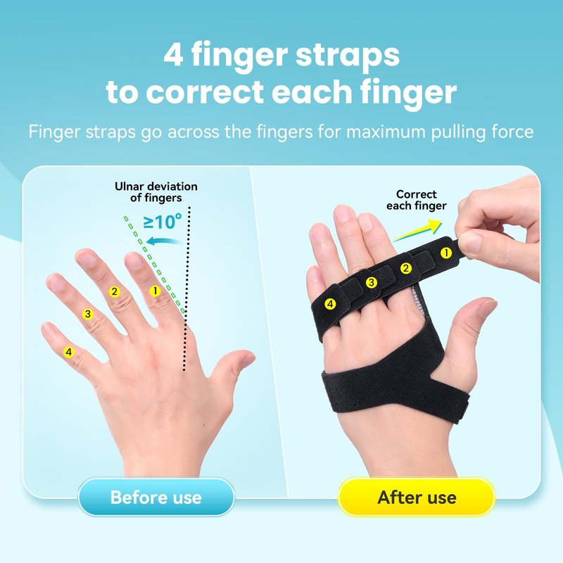 DrFinger Finger Ulnar Deviation Splint Brace, Finger Joint Deviation Orthopedic Corrector With Metal Bracket-Black-(Right-M)