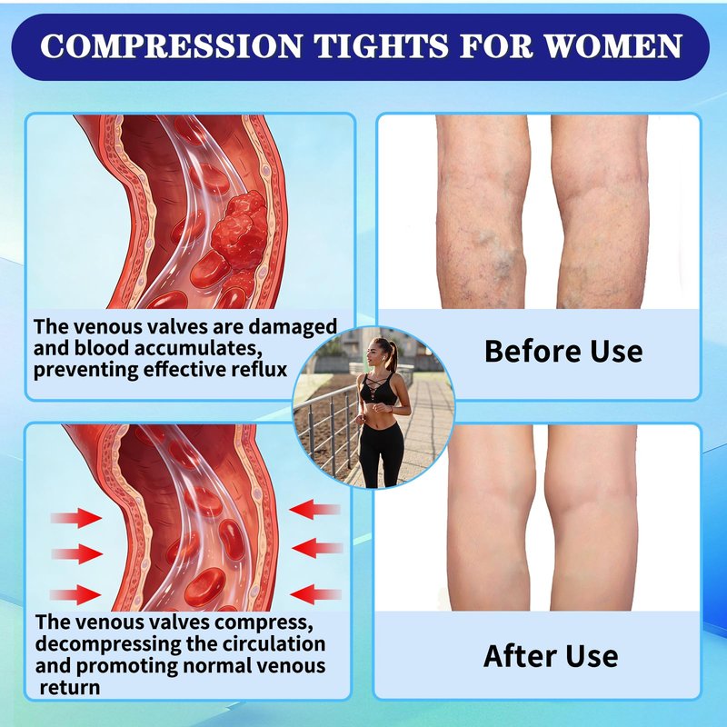2 Pairs 20-30mmHg Compression Pantyhose for Women & Men, Medical Graduated Compression Leggings for Women, Footless Compression Stockings Support Compression Tights for Varicose Veins, Edema, Dvt