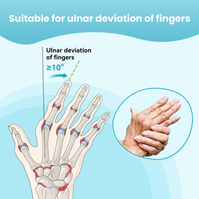 DrFinger Finger Ulnar Deviation Splint Brace, Finger Joint Deviation Orthopedic Corrector With Metal Bracket-Black-(Right-M)