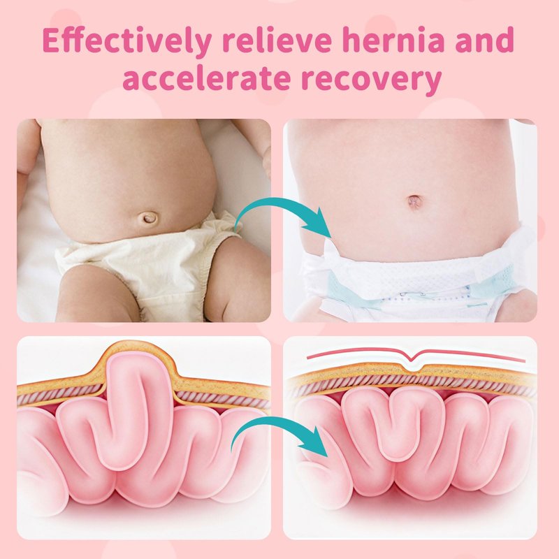 ENLUNTRA Umbilical Hernia Belt Baby，baby belly button band with 3 Different Shaped Compression Pads,belly button shaper,Adjustable Navel Band Newborn Umbilical Cord 14-21 inch(Pink)