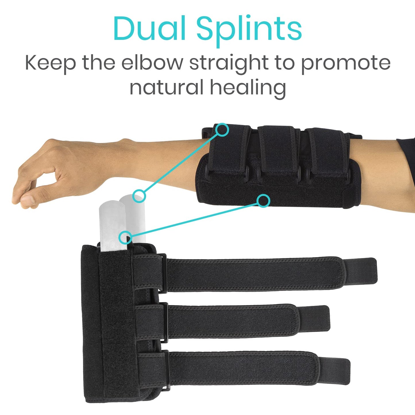 Vive Elbow Splint Brace for Tendonitis, Cubital Tunnel, Sleep Support, Tennis Elbow - 2 Removeable Splints That Stabilize Joint for Pain Relief - Arm Compression Sleeve Immobilizer for Men and Women