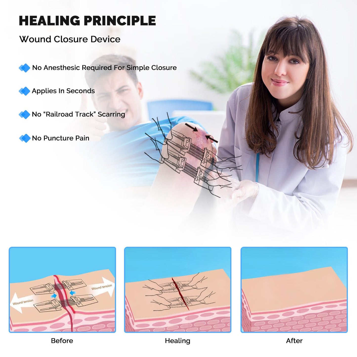 Emergency Wound Closure Strips, 5 Pcs Zip Stitch Butterfly Bandages for Wound Closure, Steri Strips Alternative for Lacerations, Easy Pull Skin Closure Device for First Aid Kits, Home & Outdoor Use