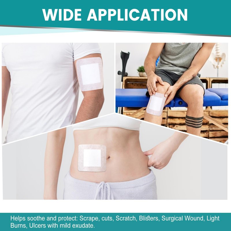 150 Count Island Dressing Bordered Gauze 4" x 4", Gauze Pads Individually Wrapped, Non-Stick Pad in Center with Adhesive Border, Bandages for Wounds, First Aid