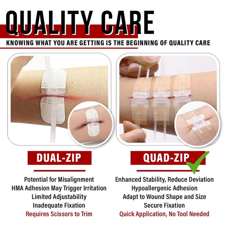EVERLIT Wound Closure Pack | 4 Pcs Surgical Wound Zip Devices for Cut & Laceration Wound Repair | Sterile, Suture-Free, Stitch-Less Adhesive Butterfly Bandage Strips for Emergency First Aid Care
