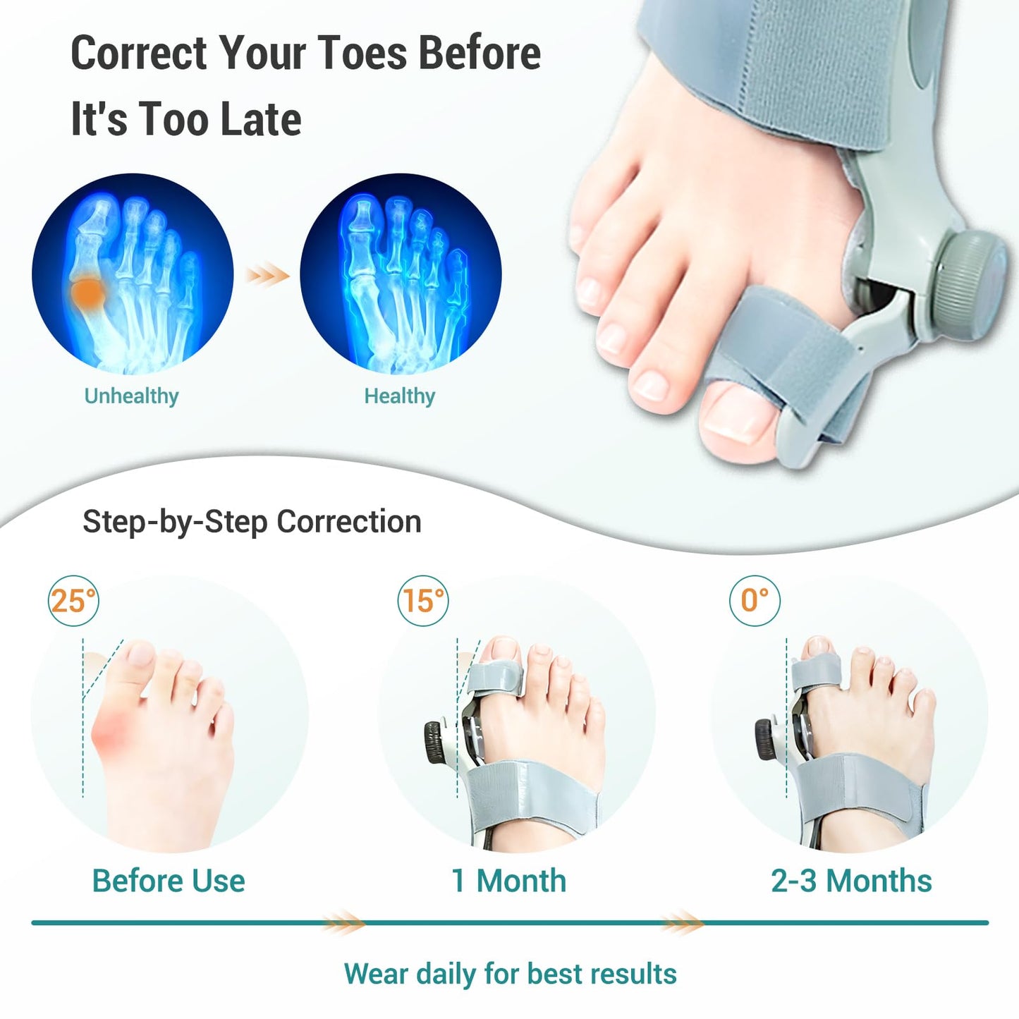 Bunion Corrector for Women Big Toe - US Patent 3 Precision Angles (0°/7.5°/15°) Adjustable Toe Straightener & Bunion Splint Brace with Extra Straps & Toe Separator, Fits Left & Right Foot by EliaValth, Large, Brown 1 PACK