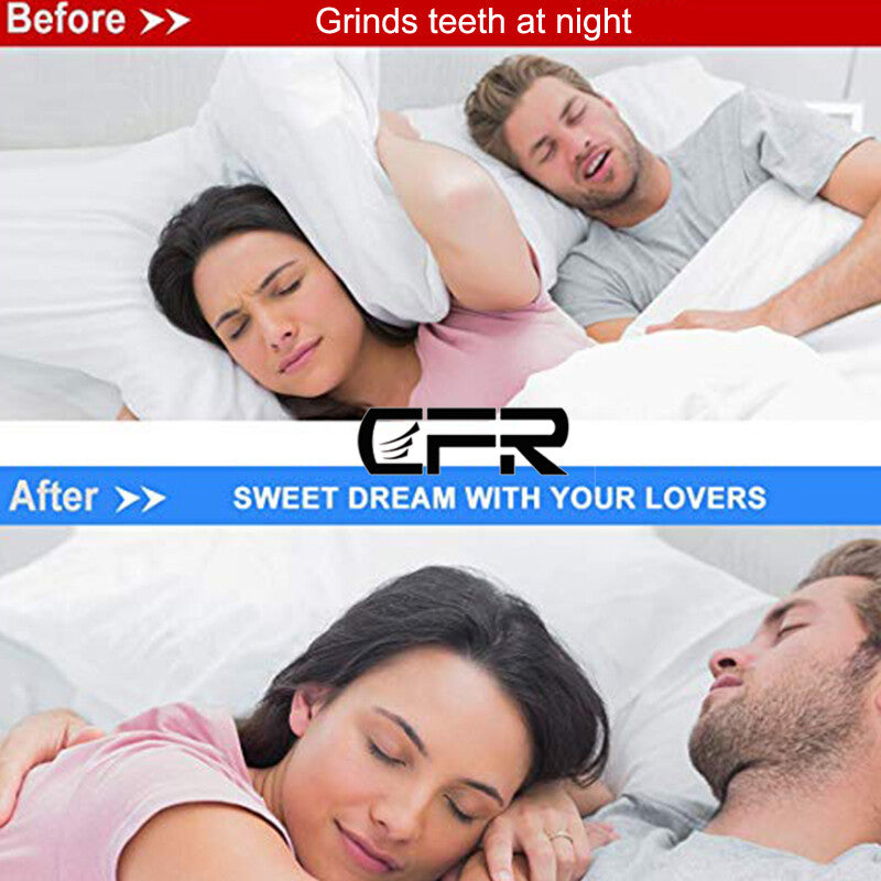 Senior Teeth Protector Mouth Guard for Boxing Basketball Gym - Gum Shield