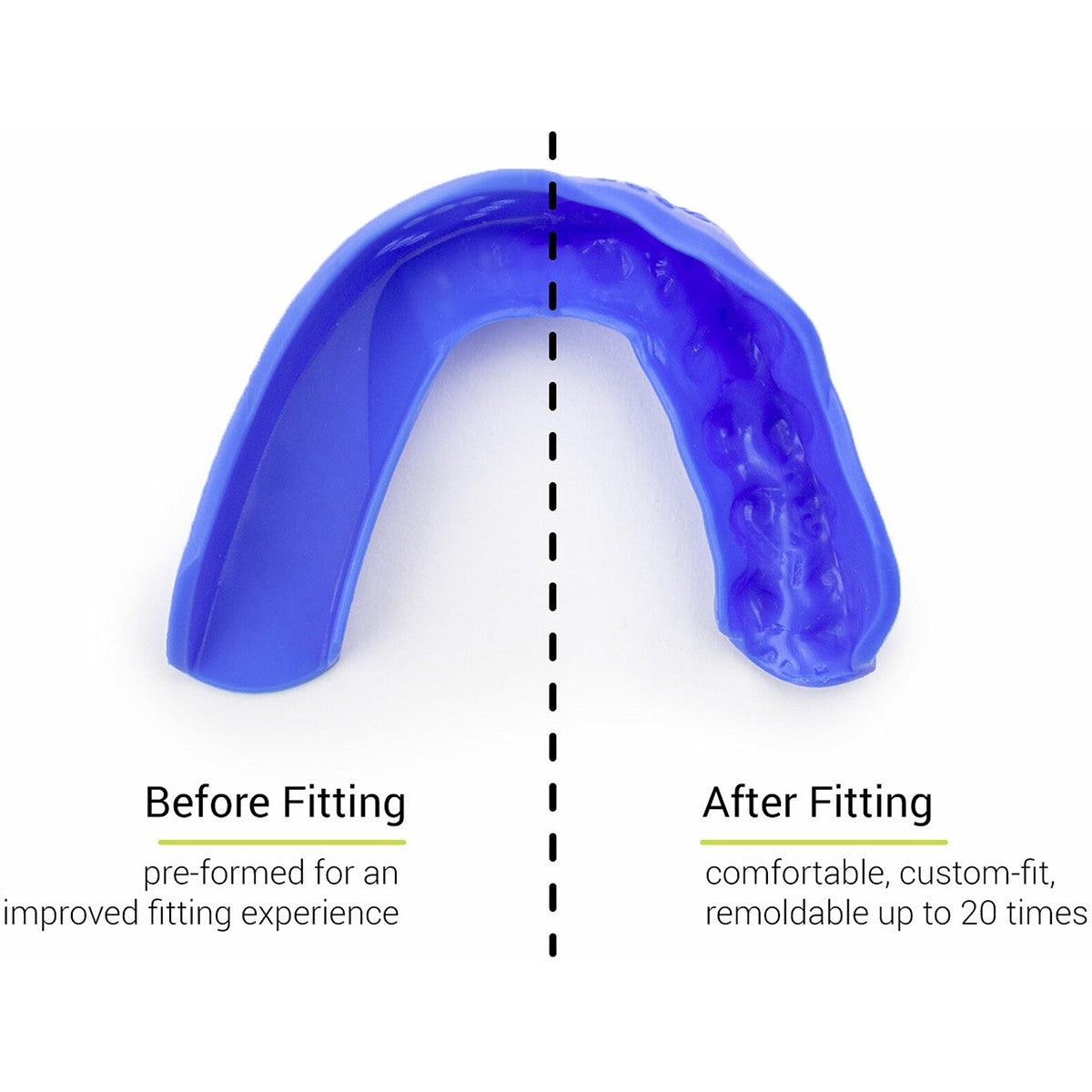 Adult Mouthguard for Sports Protection Custom Fit Reusable Dental Guard